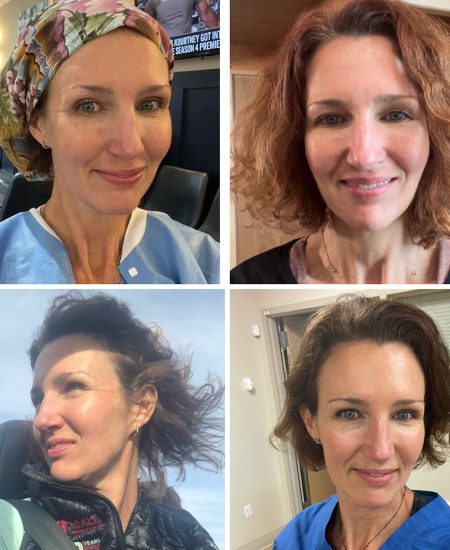 Pics that have prompted DMs asking what I use on my face